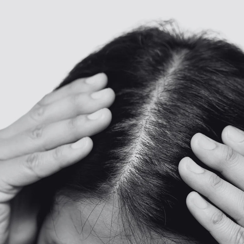 Hair Loss and Thinning