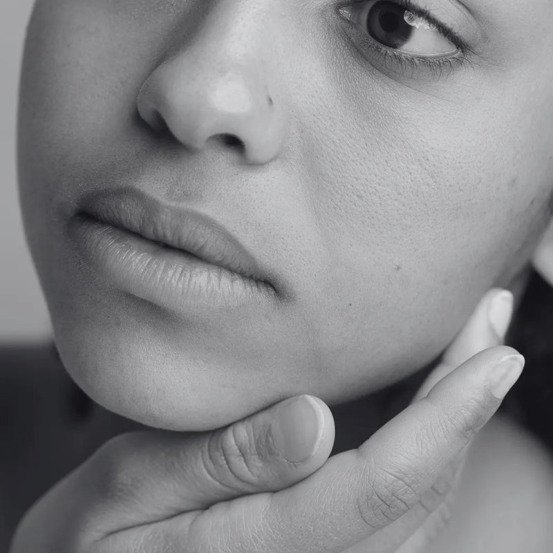 Dull and Dry Skin