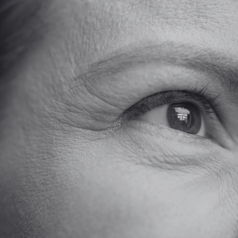 Fine Lines & Wrinkles